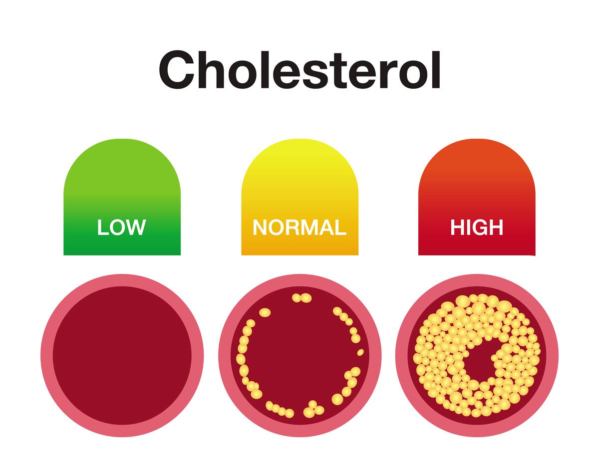 Cholesterol-Low-Normal-High